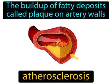 Atherosclerosis Meaning
