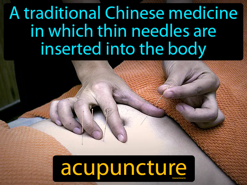 Acupuncture Definition Acupuncture Definition
